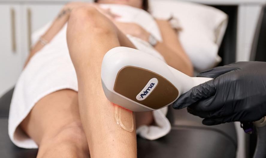 Is Laser Hair Removal Worth the Investment? A Comprehensive Guide